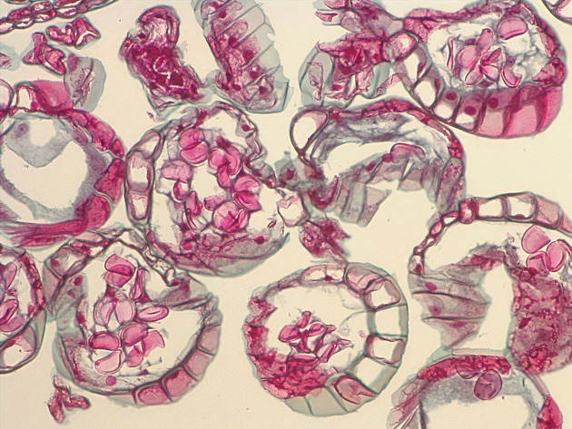 Mature Sporangia Slides - Mature Sporangia 02 200X